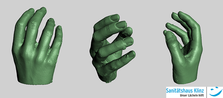 Gesunde rechte Hand | Digitalisierung in Artec Studio